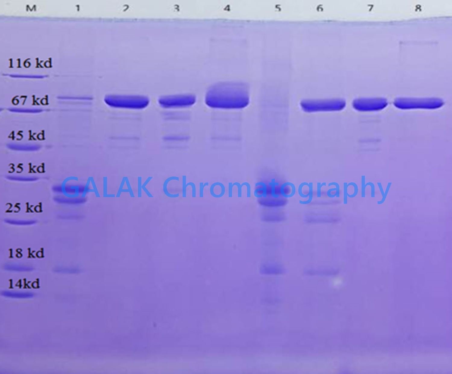 Lactoferrin purification